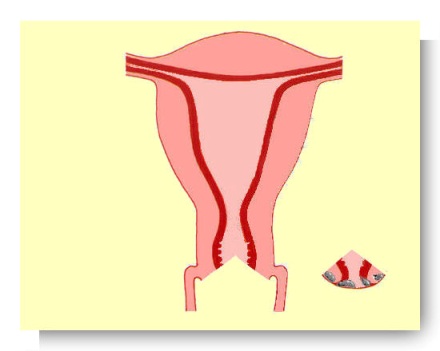 col de l'utérus 2