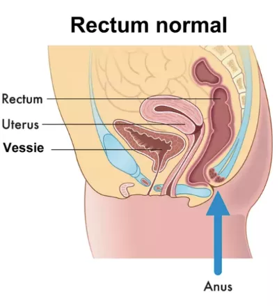 rectum normal