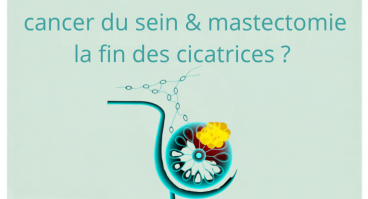 mastectomie_endocscopie